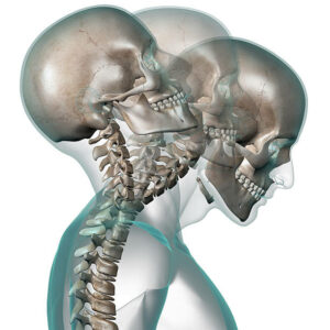 X-ray of a human head showing a example of contortion: the neck bending back and forward. Side view, isolated on white background.